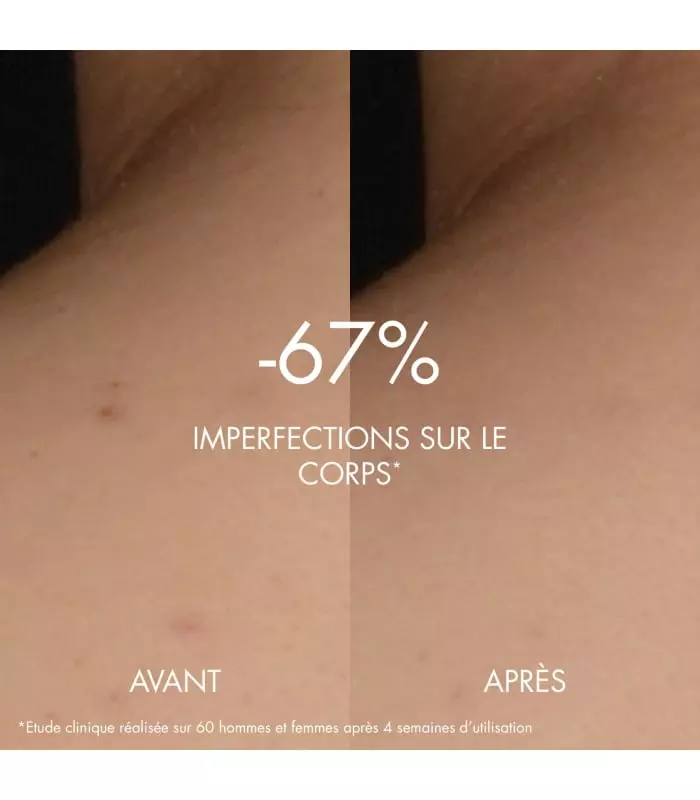 BIOTHERM BIOCORPS Serum Anti-Imperfections