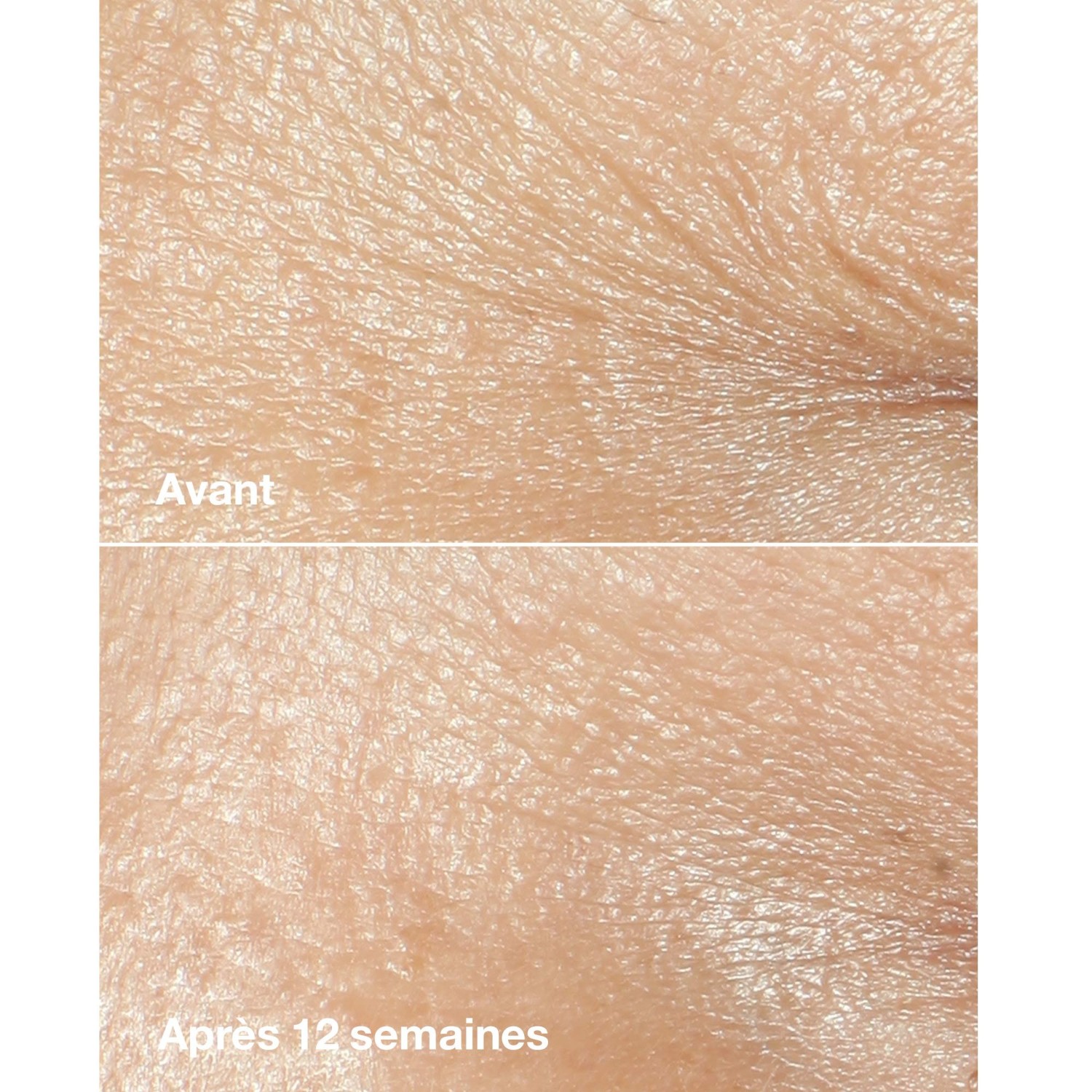 Clinique Rich Anti-Wrinkle Corrective Cream