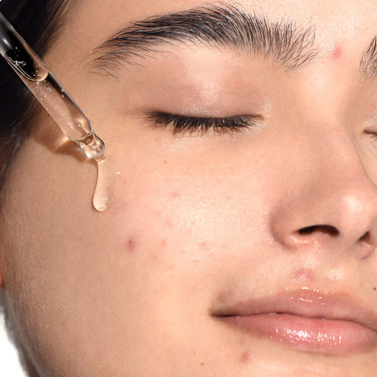 Tratament facial cu acid shikimic - Ser facial anti-pete
