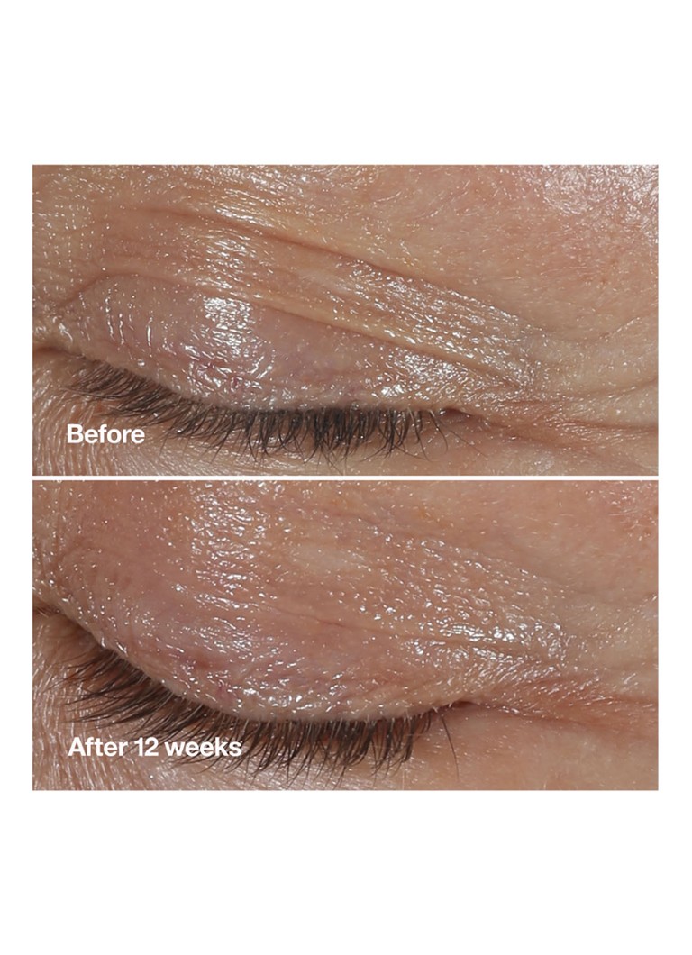 CLINIQUE Smart Clinical Repair™ očný krém na korekciu vrások - očný krém