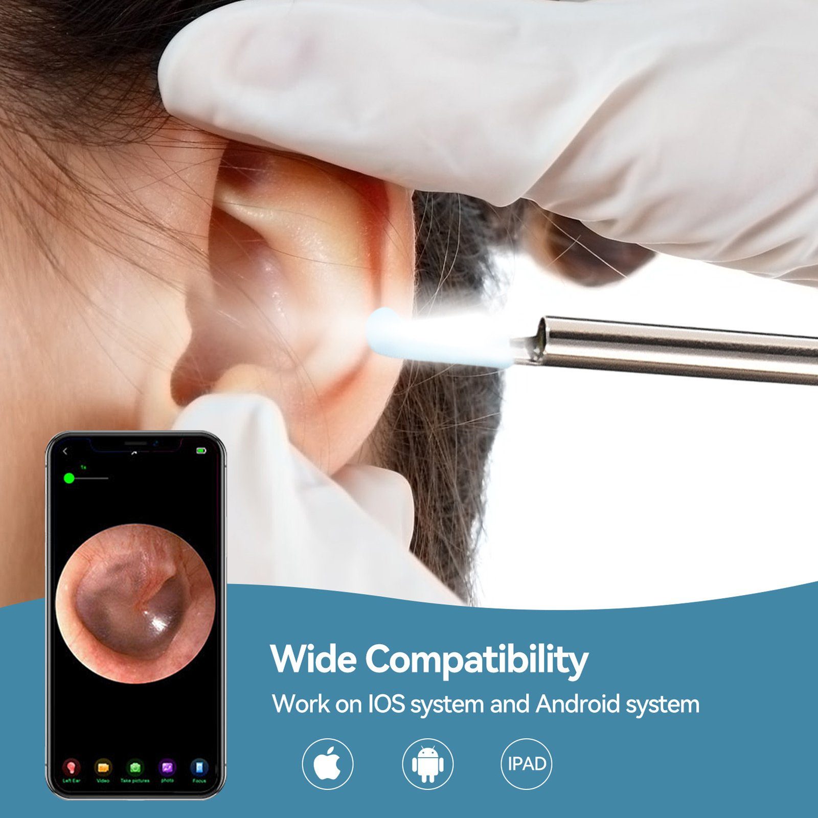 SEEZSSA Ohrenreiniger Advanced Das Ear Scoop mit WIFI Ear Scope, Ohrlöffel aus Eisen zur Reinigung von Ohrenschmal, Ohrlöffel mit 230mah Li-Ion-Akku mit Silikon-Ohrlöffel, Schwarz/Weiß
