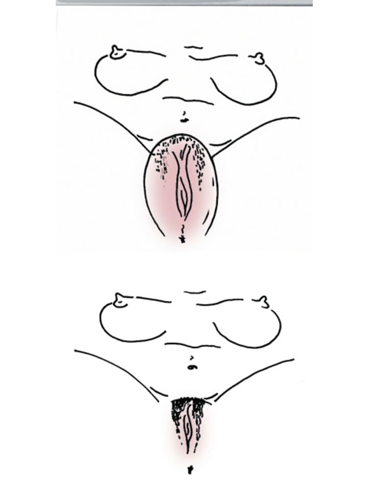 You2Toys Vaginasauger Vagina Sucker in transparent günstig kaufen 12,5