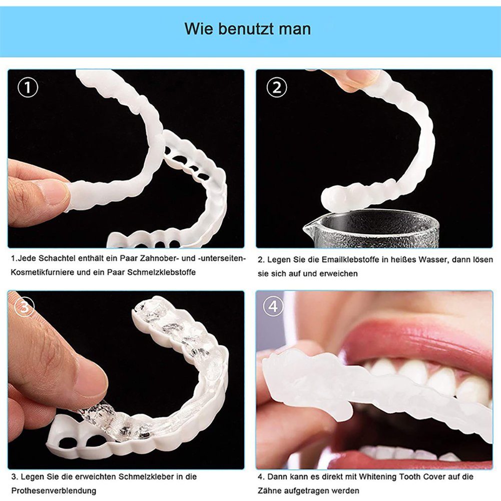 Orbeet Mundpflegecenter Snap On Veneers Kosmetische Zahnblende Comfort Prothese Falsche Zähne