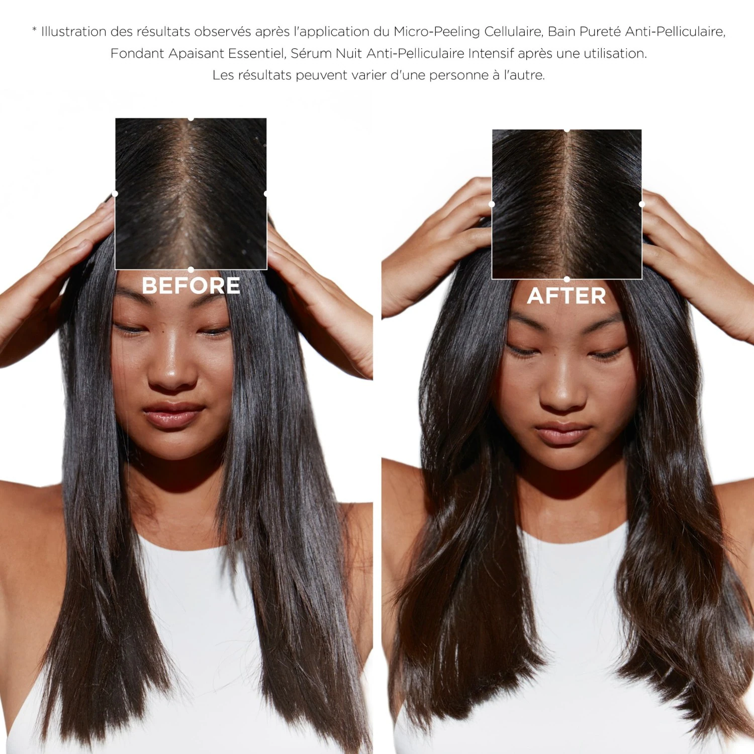 Kérastase Intensive Anti-Dandruff Night Cellular Serum