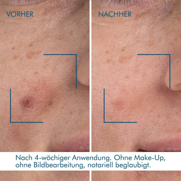 Biotherm Blue Retinol Night Serum Gesichtsserum
