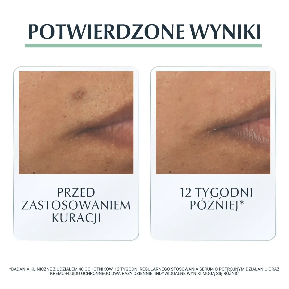 Eucerin Dermopure trigubo poveikio serumas
