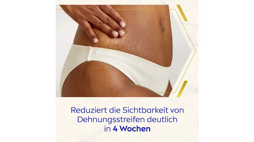 Nivea Luminous Body Creme Anti-Dehnungsstreifen 200 ml