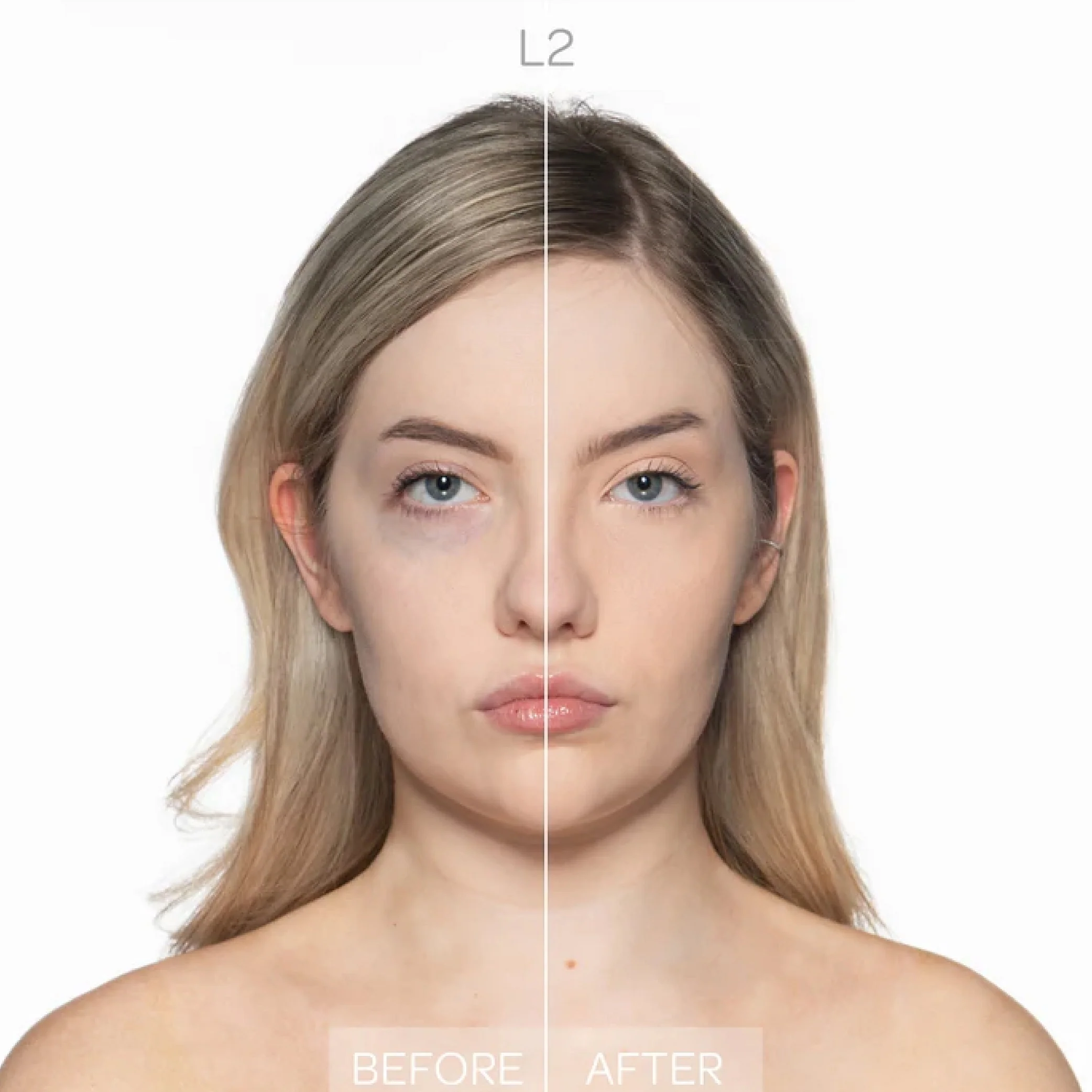 Corrector de impacto facial