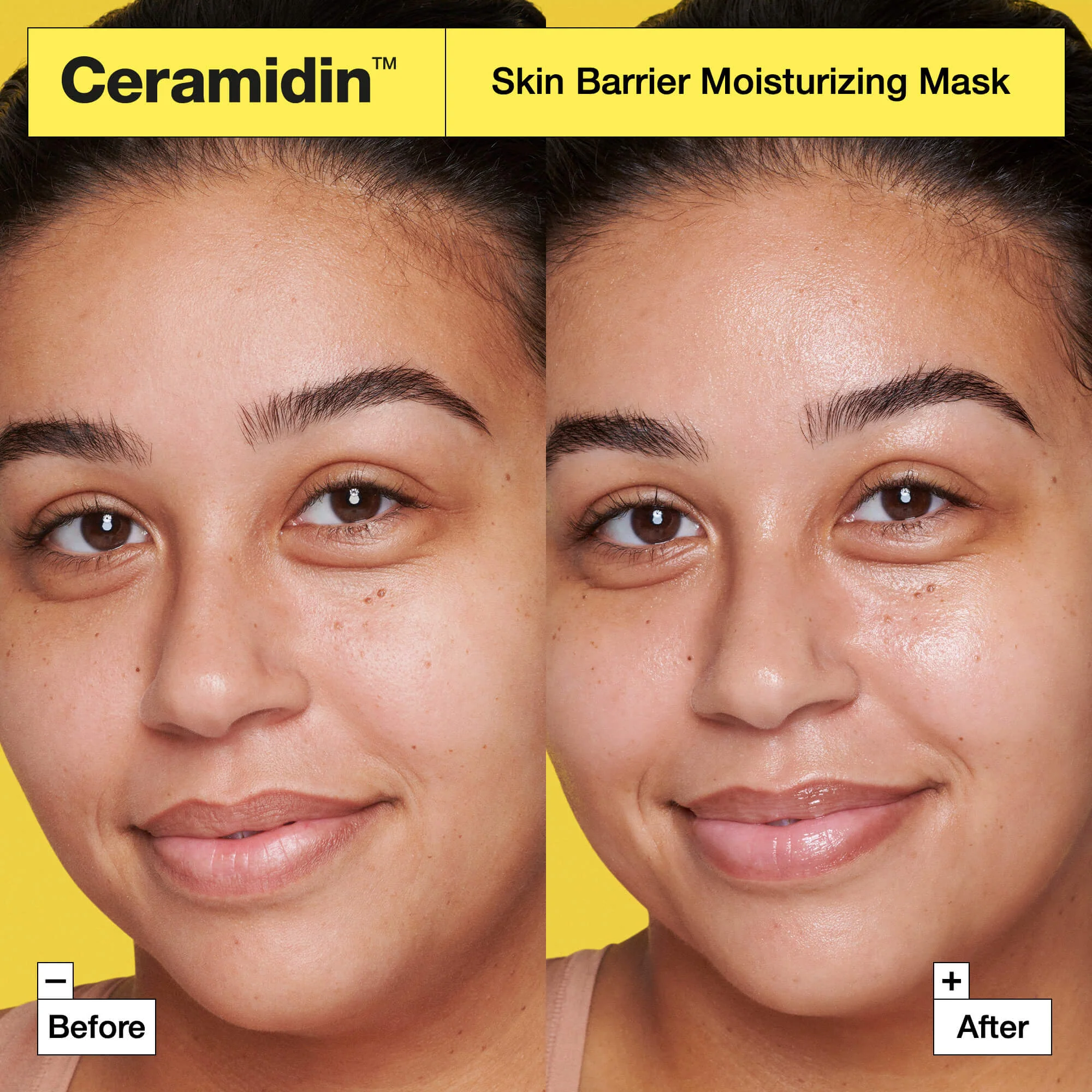 Hydratačná maska Ceramidin™ Skin Barrier - Hydratačná pleťová maska