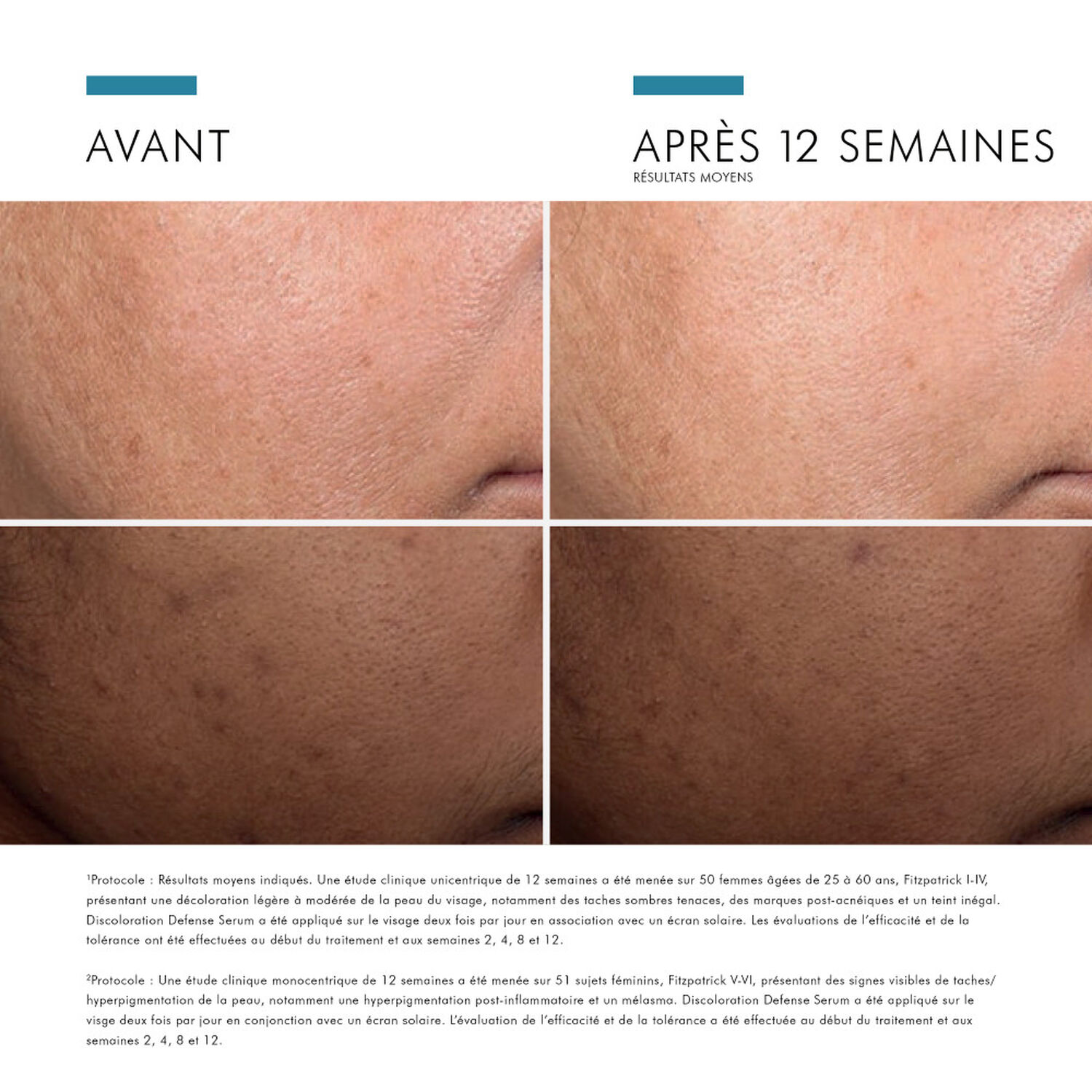 Skinceuticals Discoloration Defense Sérum Anti-Tâches 30 ml