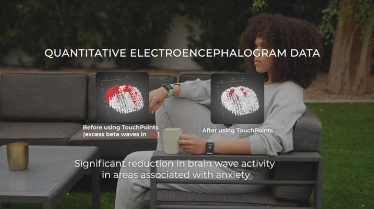 Touchpoint Fitness-Tracker Touchpoints Neurostimulator zum Stressabbau und Konzentrationsverbesse