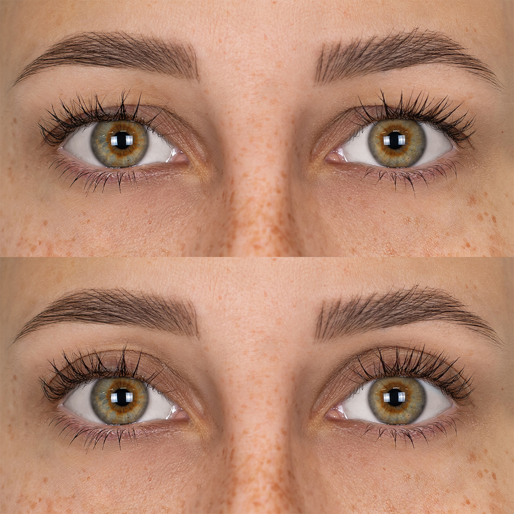 Fleeky Bandes Paupières Magic - Solution contre Paupière Tombante Patch yeux
