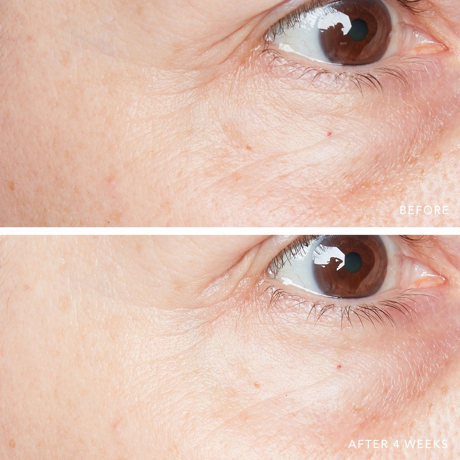 Lansering av 3D hyaluronsyre øyeserum