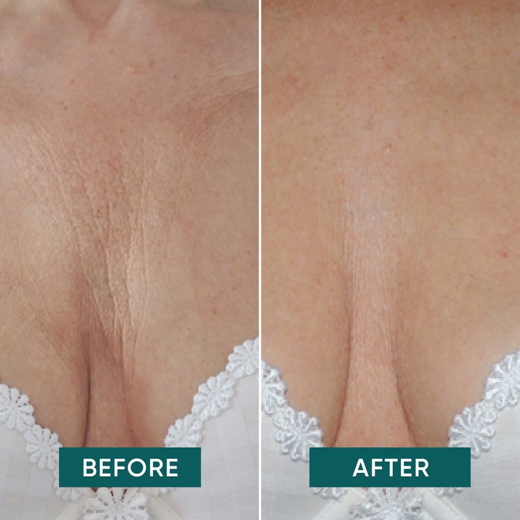 Décolleté Pad
