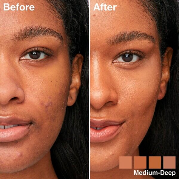 Maybelline New York Instant Anti-Age Perfector 4-in-1 Glow Medium Deep Concealer 20ml