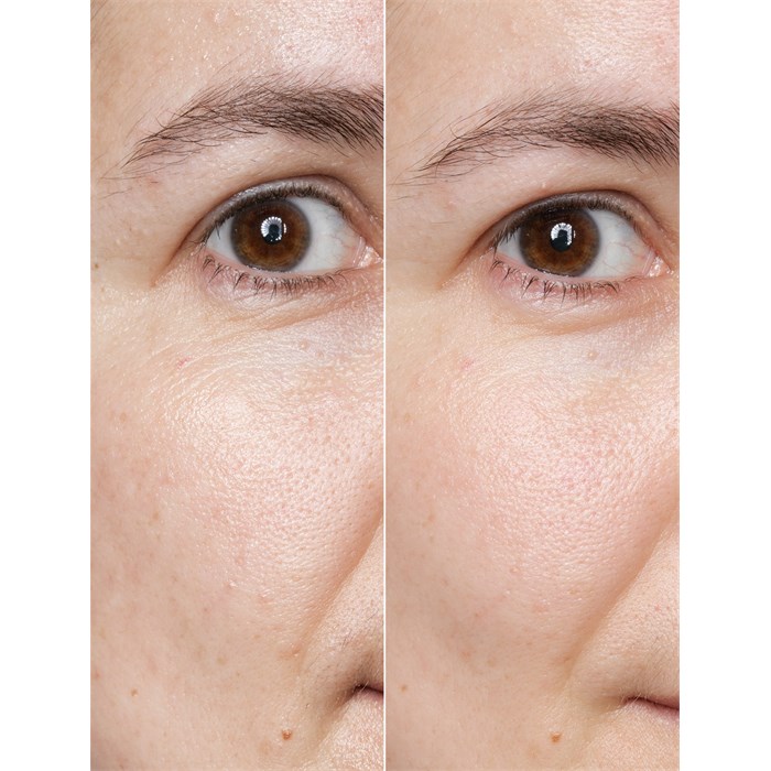 Retinol Power Serum Ampoules