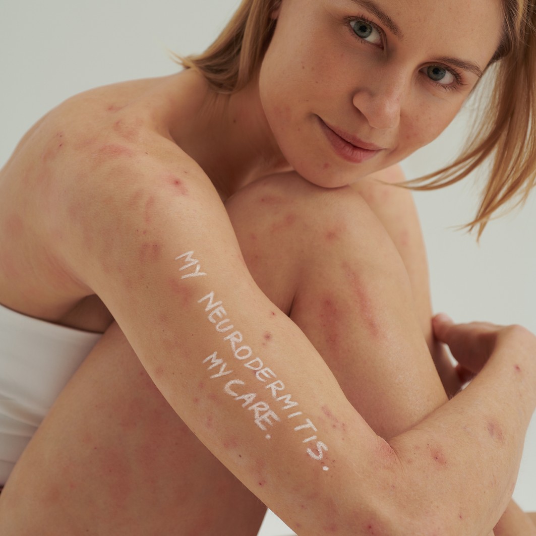 DADO SENS Dermacosmetics sausai odai ir neurodermitui