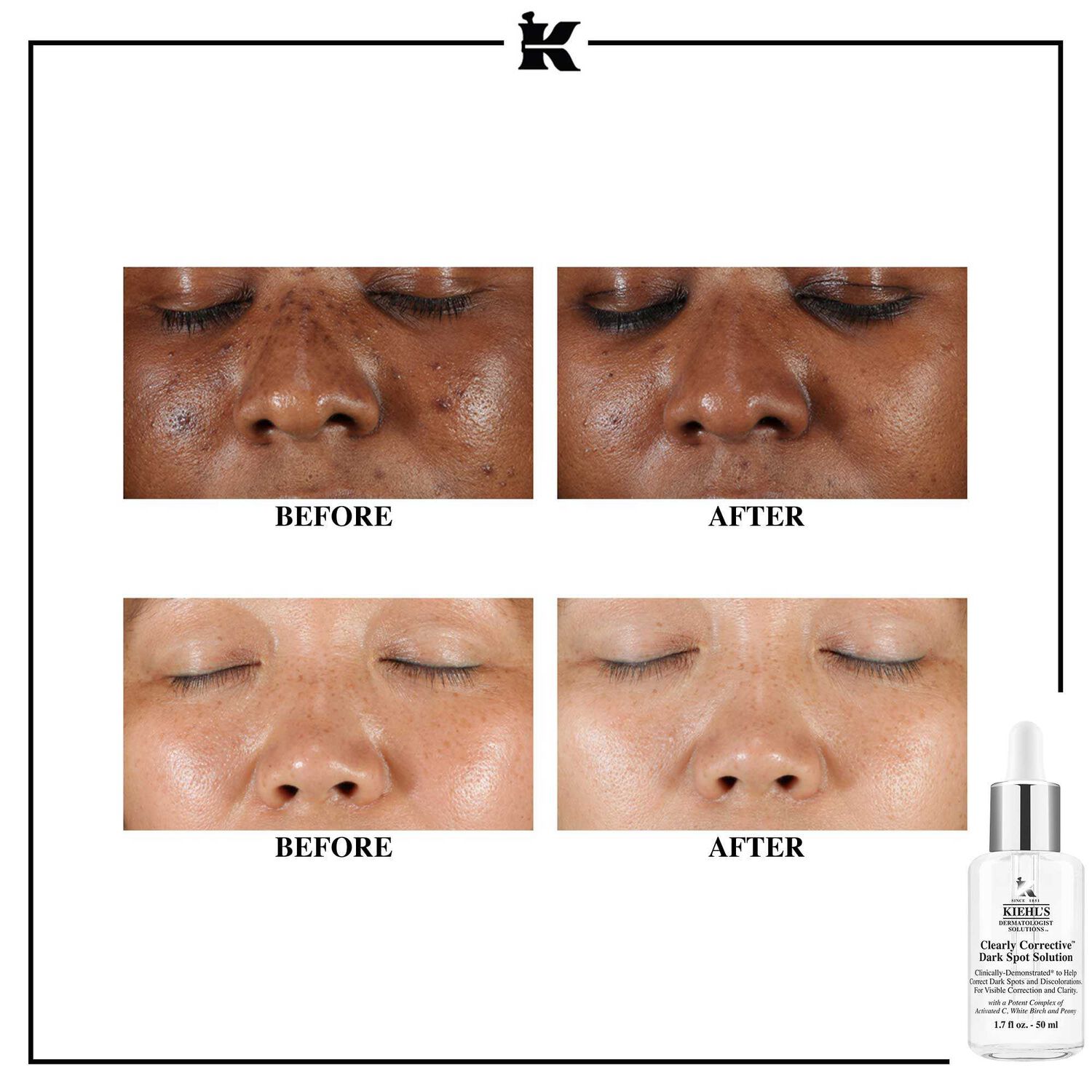 kiehl's Clearly Corrective™ Dark Spot Solution Sérum unifiant et réduisant l'apparence des tâches pigmentaires