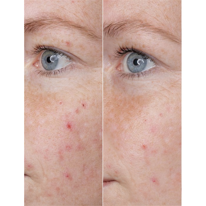 Hyaluronic Acid Power Serum Ampoules