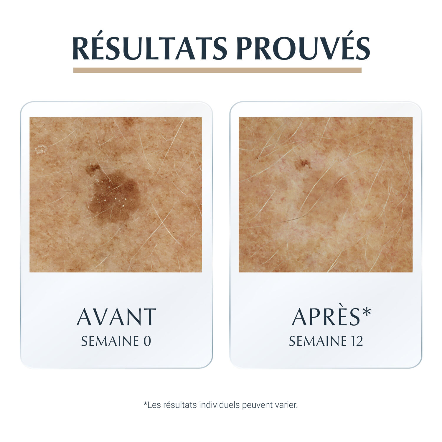 Eucerin Hyaluron Filler +Elasticity Sérum Anti-Age, Tâches Brunes & Rides