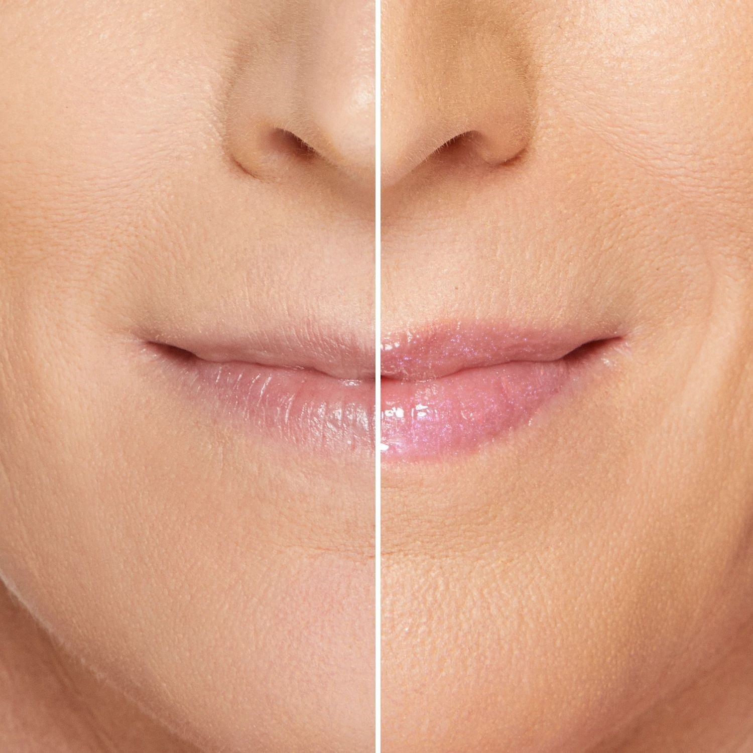 Lip Injection Maximum Plump