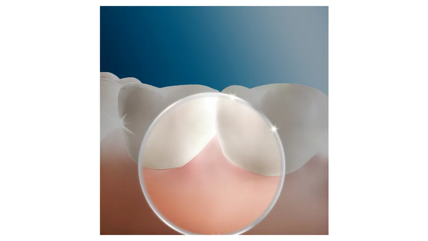 Oral-B Ersatzdüsen OxyJet 4er