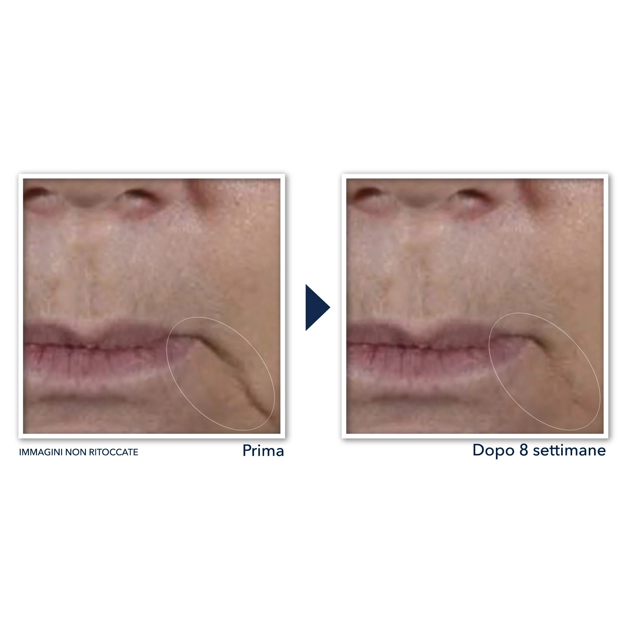 Creme facial Multi Correxion Firm + Lift - Tratamento de lifting facial de 24 horas