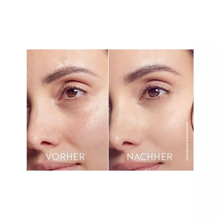 MAGIC CARE Perfect Eye Augenserum Probe