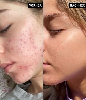 The INKEY List Niacinamide Serum Gesichtsserum-30 ml