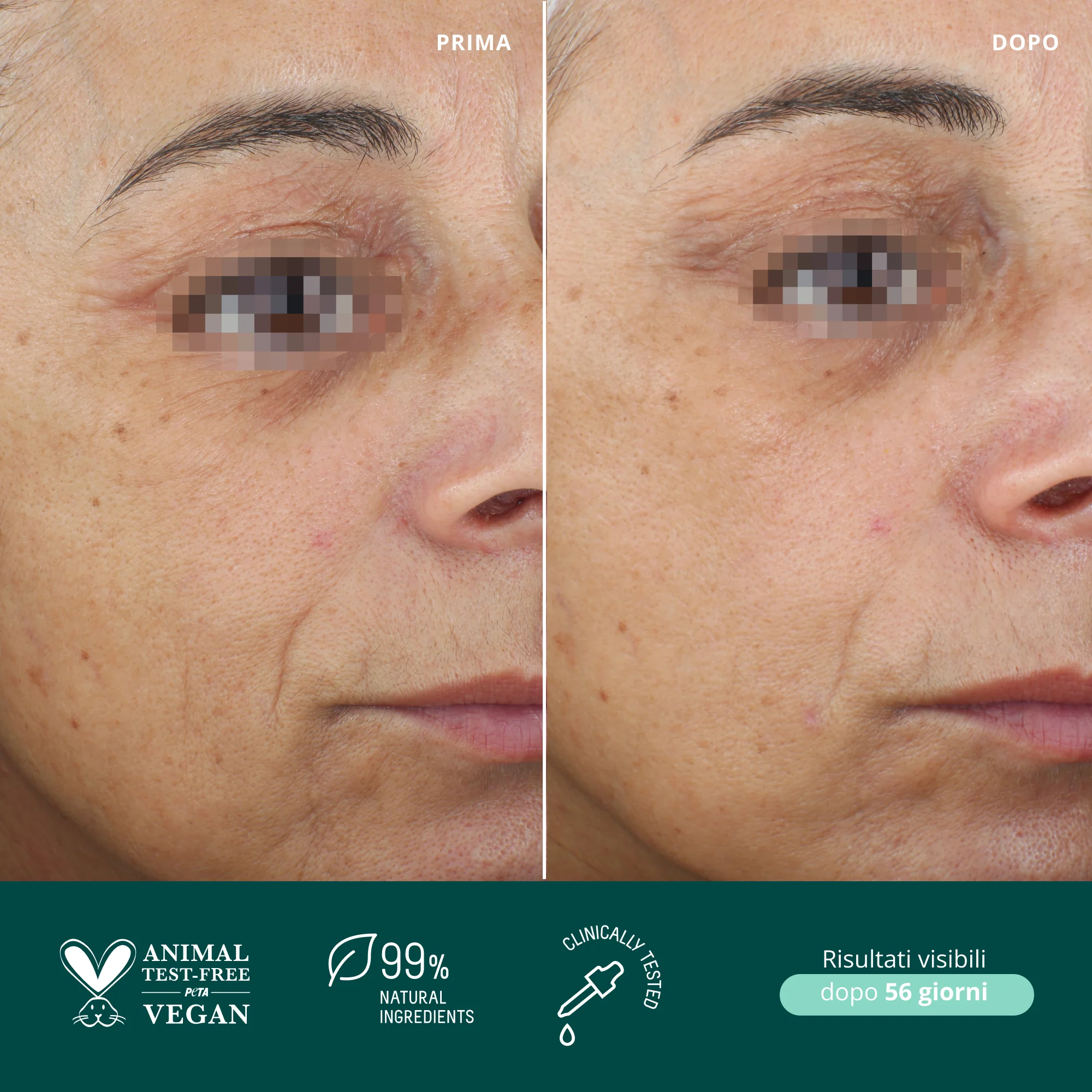 „Phoenix Aura Well“ senėjimo serumas – veido serumas nuo raukšlių