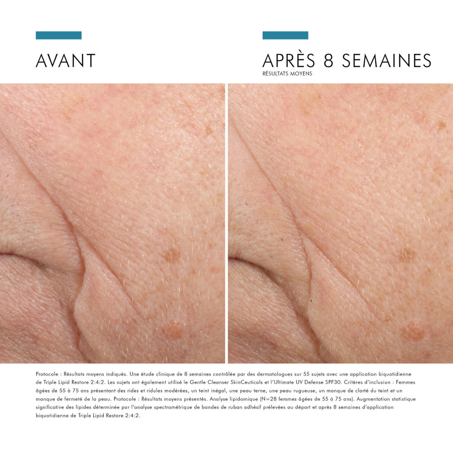 Skinceuticals Triple Lipid Restore 2:4:2 Crème Anti-Rides Régénérante et Nourrissante 48 ml