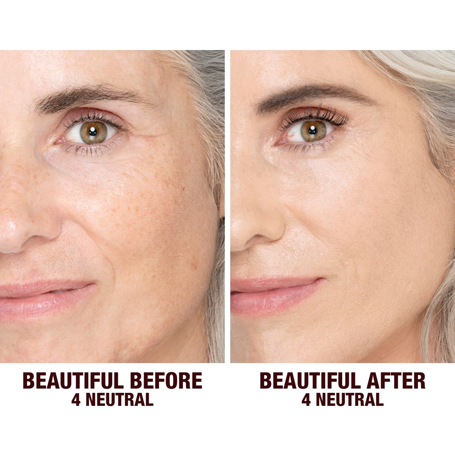 Charlotte’s Beautiful Skin