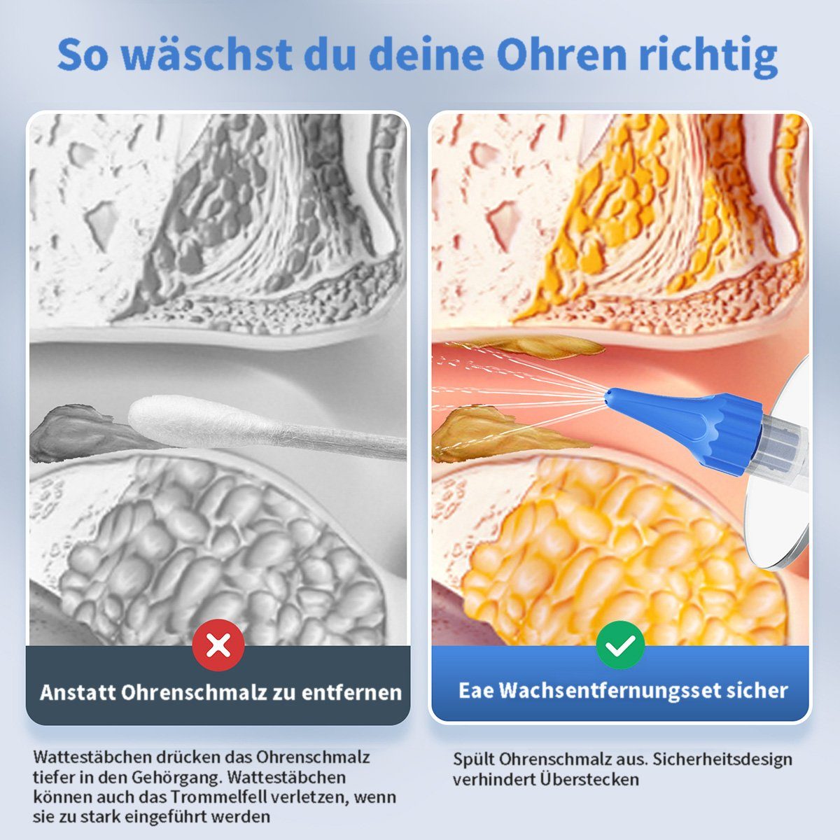 götäzer Ohrenreiniger Manuelle Ohrreinigungssysteme,Ohrenschmalzentfernung,Ohrreinigungskits, 1-tlg., Sicher und wirksam, verbessert das Gehör und beugt Krankheiten vor