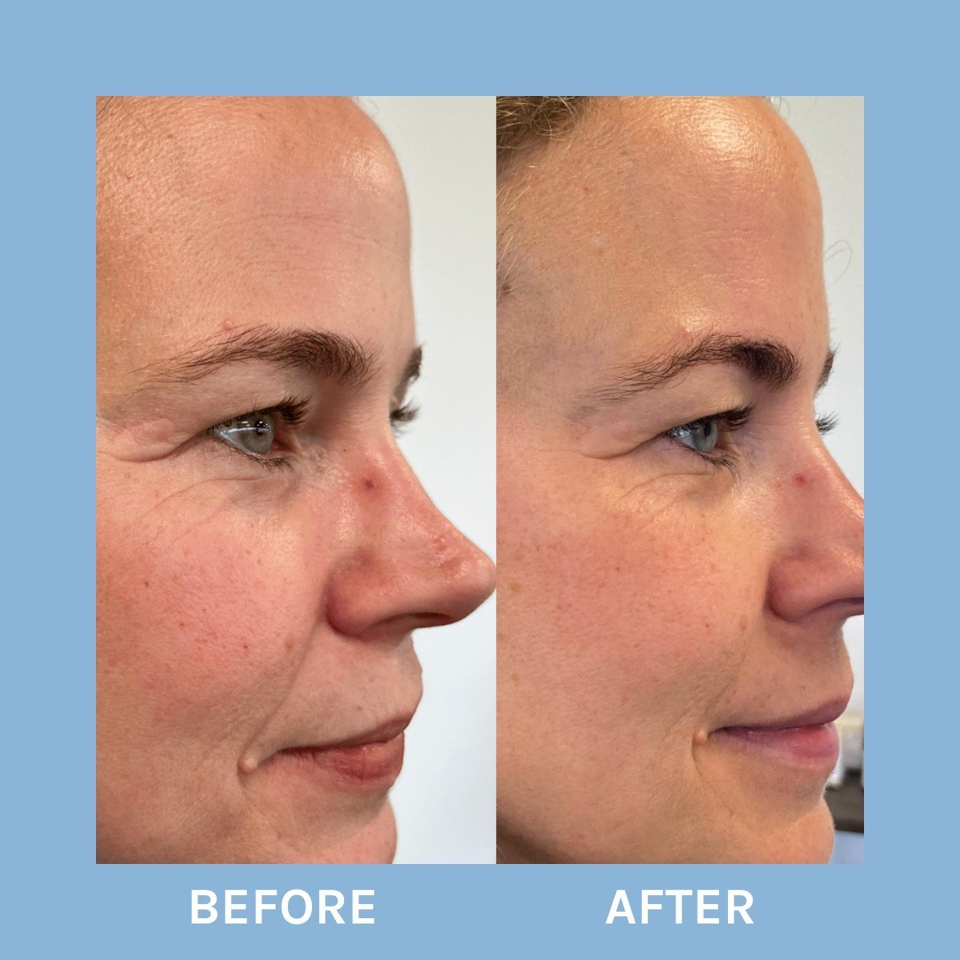 Evolve Organic Beauty serum za lifting protiv starenja