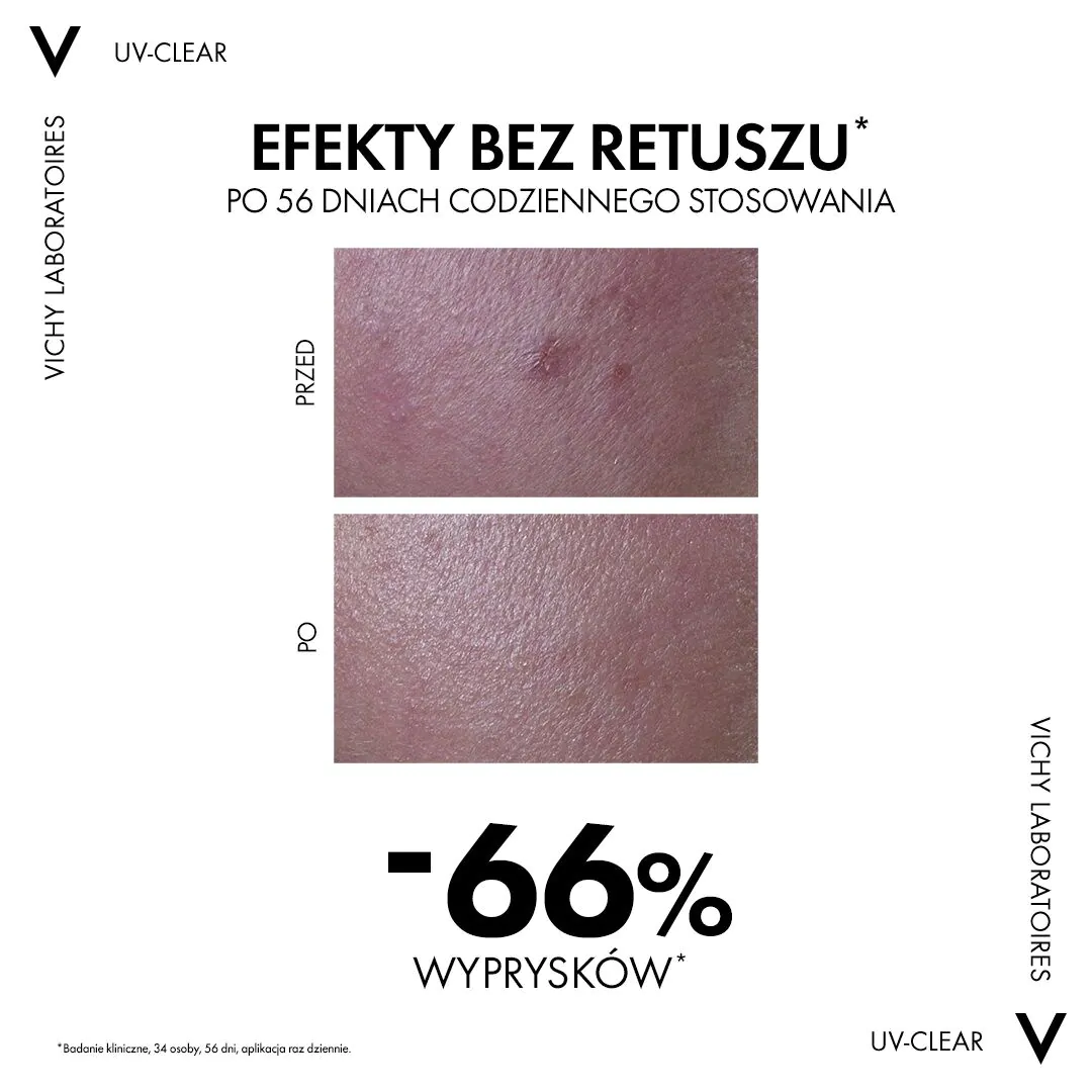 Vichy Capital Soleil UV Clear Fluid Anti-Imperfection SPF50+