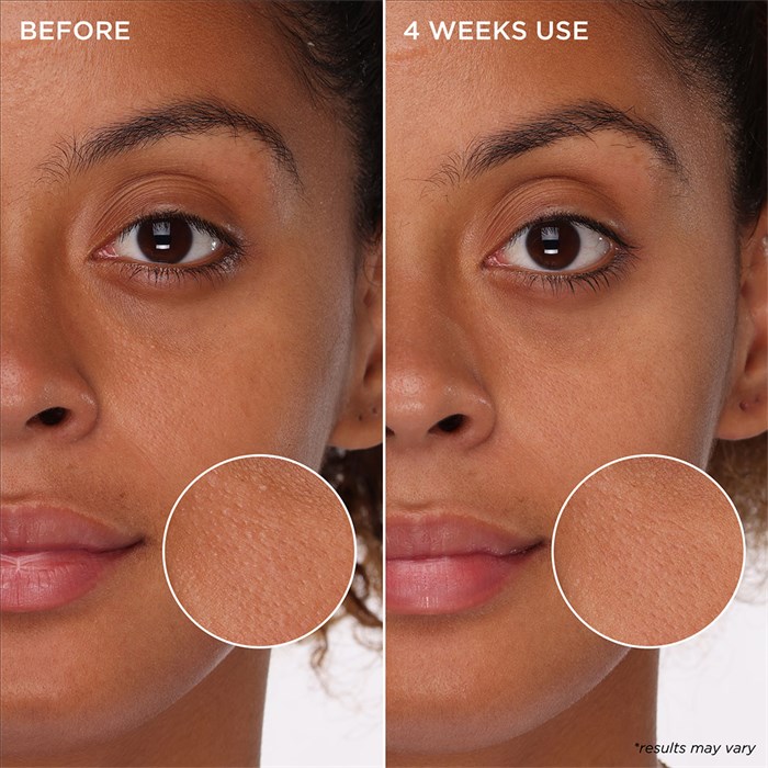 Tight 'n Toned - Poren verfeinernder Schaum-Toner mit AHA+PHA