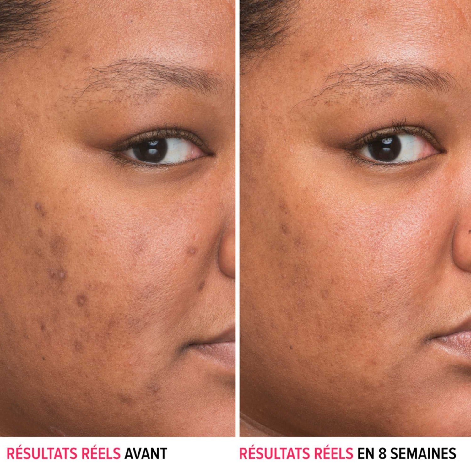 IT Cosmetics Niacynamid Serum przeciw przebarwieniom