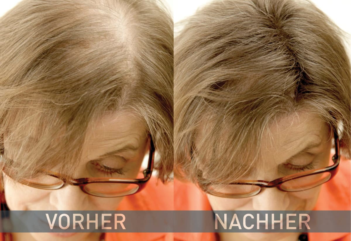 Streuhaar Haarverdichter Mittelbraun, 14 g