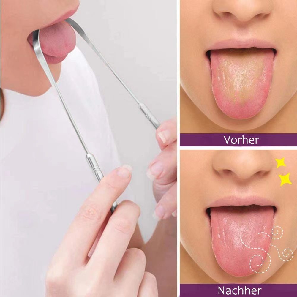 COOL-i ® Zungenreinigeraufsatz, für die tägliche Mundhygiene gegen Mundgeruch(Edelstahl)