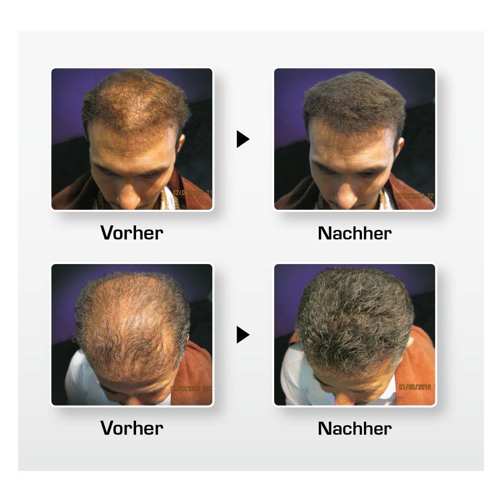 BioThik Haaraufbau-Faser S10 grau 25 g