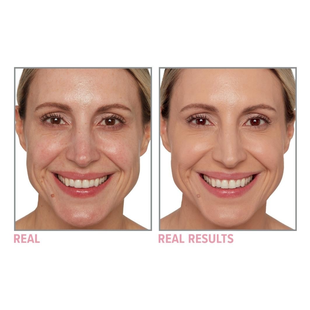 Your Skin But Better + Skincare