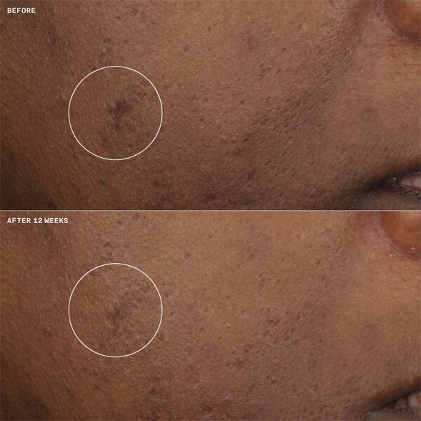 Clinique Even Better Clinical Brightening Moisturizer Tagescreme