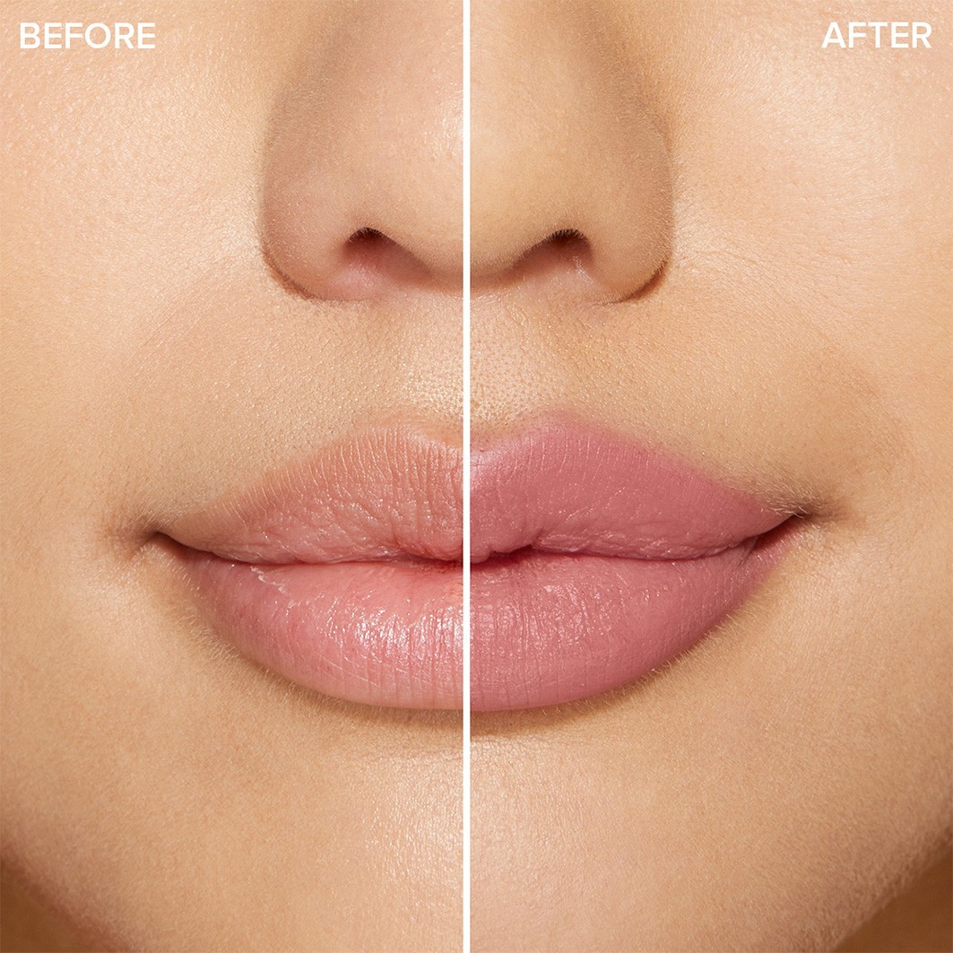 Extreme Lip Shaper