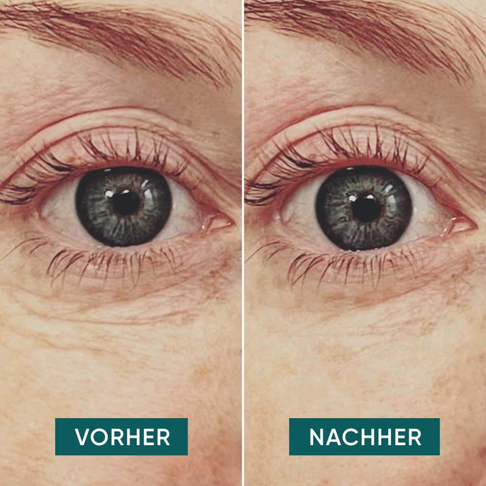 Apricot Beauty Pads Augen Pads
