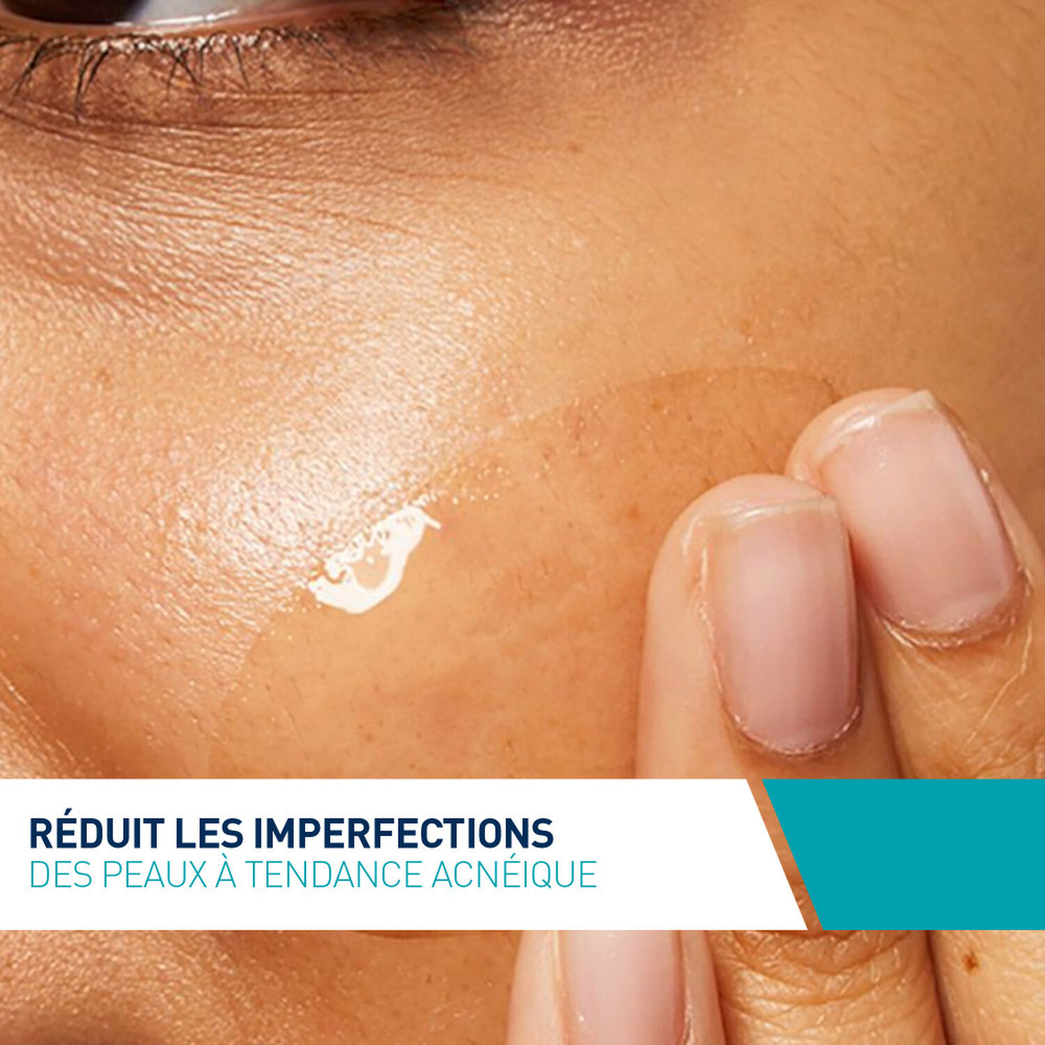 Cerave Concentré Anti-Imperfections Soin de Nuit pour Peaux à Imperfections 40 ml