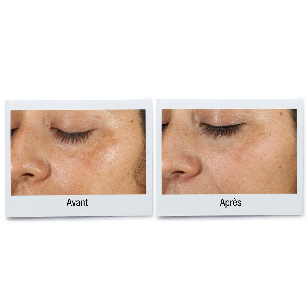kiehl's Clearly Corrective™ Dark Spot Solution Sérum unifiant et réduisant l'apparencedes taches pigmentaires