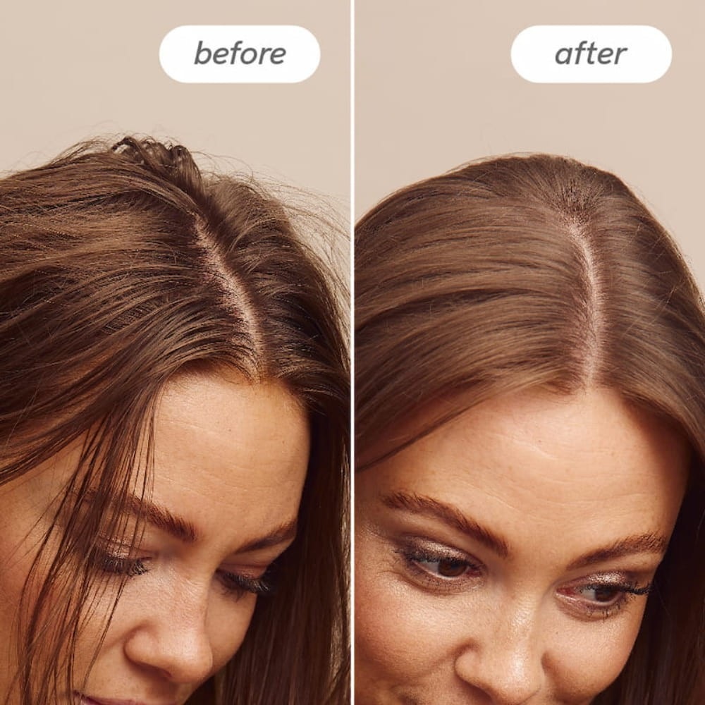 „Hairlust“ detoksikuojantis šveitiklis