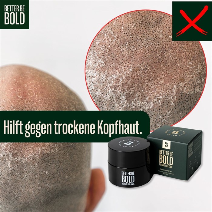 Mattierende Glatzencreme (0-3mm) mit Anti-Shine-Effekt