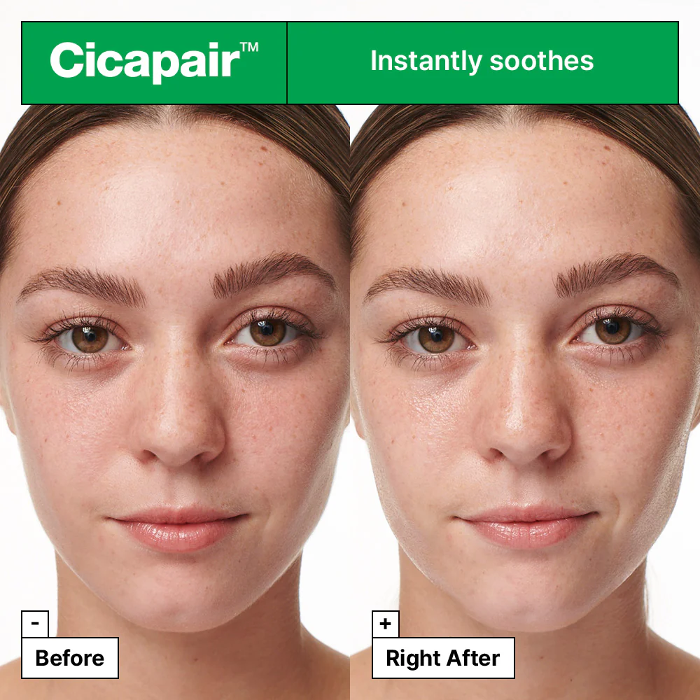 Cicapair™ Intensive Soothing Repair Serum - Umirujući serum za lice