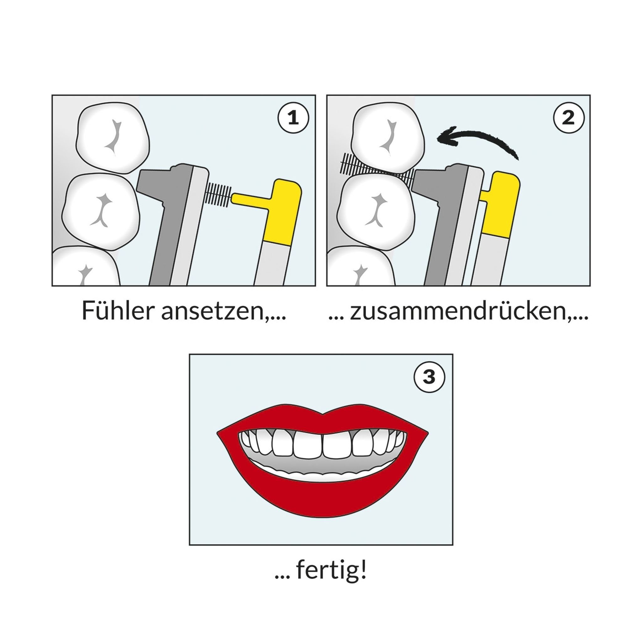 WINGBRUSH Zahnpflege-Set Gelb, 3x Bürstenaufsätze 8x Aufsätze ISO 0 - S